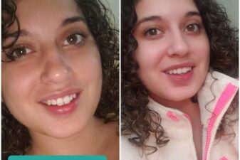 Smile direct club dental retainers nda customer refunds