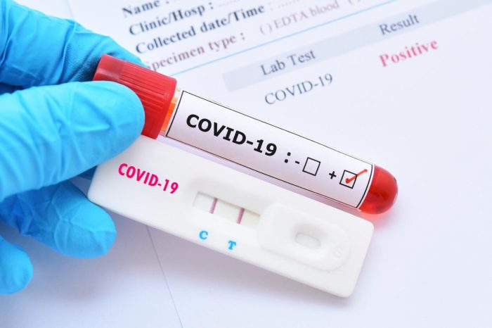 Covid testing vaccine health department funding