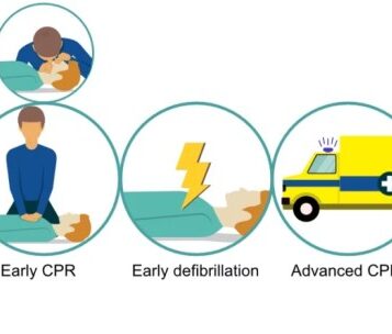 Cardiac arrest women cpr emergency